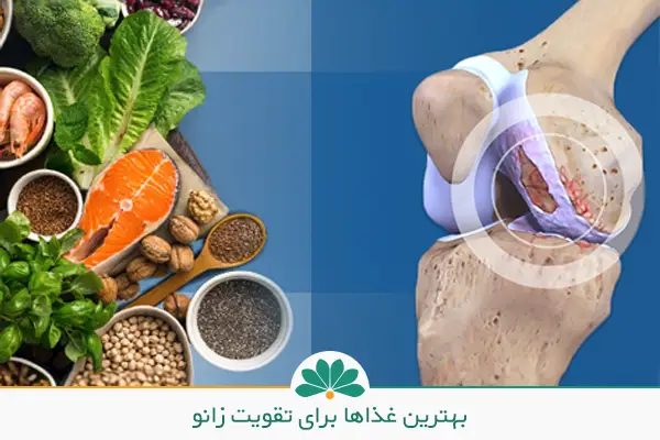 برای زانو درد چی بخوریم و درمان زانو درد با زردچوبه | تغذیه، مکملها و روشهای کمعارضه