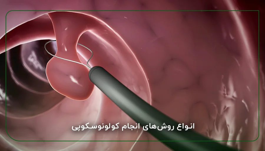 آشنایی با خطر ناک ترین مشکلات روده